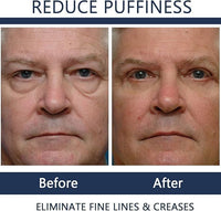 Men Eye Cream Anti Aging