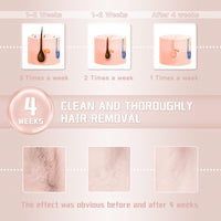 IPL Laser Hair Removal Device - display